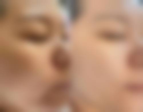 七、陕西宝鸡亿美医疗美容医院预约挂号方式及流程