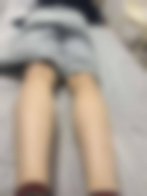 二、陕西宝鸡亿美医疗美容医院是正规医院吗