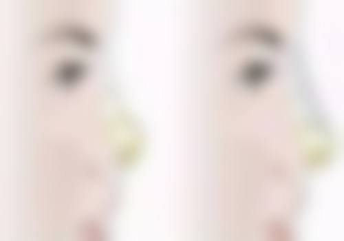 李进雯医生价格表