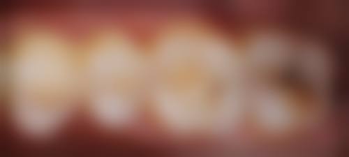 {河北儿牙医院24小时在线咨询：河北省儿童医院、廊坊紫丁香口腔，专业诊疗+贴心服务！ 