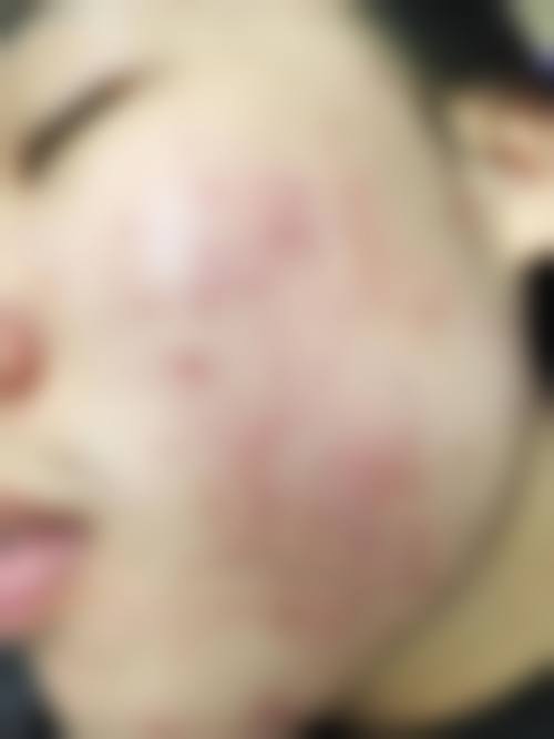 四、清远养和整形医院特色项目及技术优势