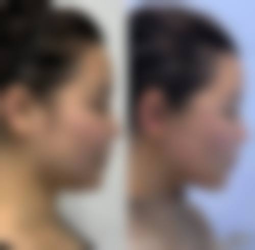 二、郑州市二七区星辰医疗美容诊所是正规医院吗