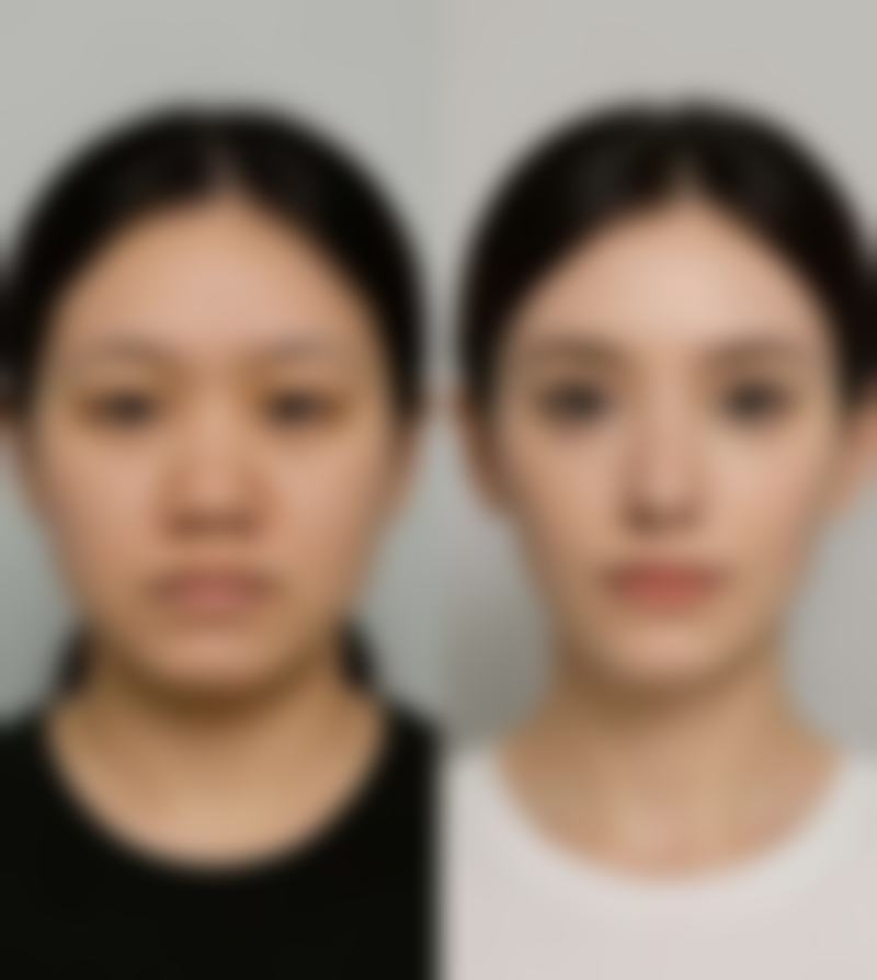 李进雯医生预约挂号