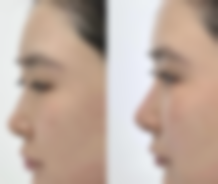 二、无锡美呈整形医疗美容门诊部是正规医院吗