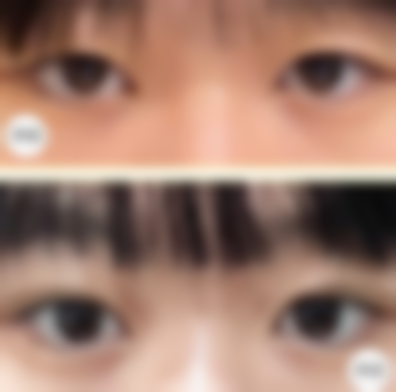 五、无锡美呈整形医疗美容门诊部收费价格表