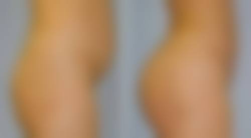 六、武汉美帝尔医疗美容门诊部口碑怎么样