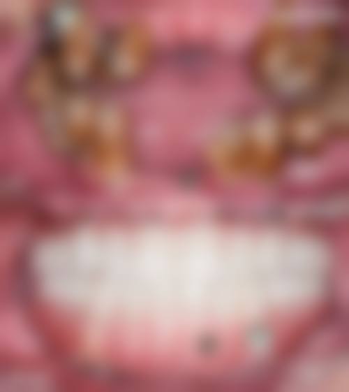 南宁诺贝尔口腔医生正畸特色