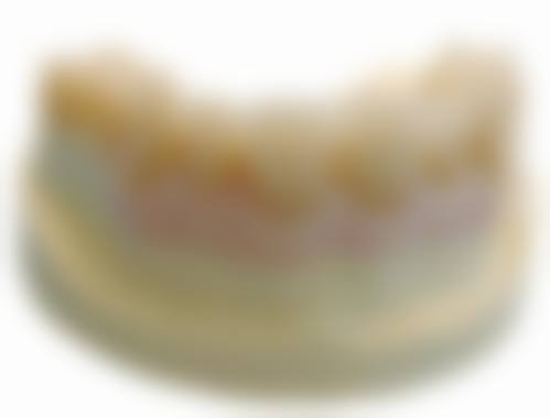 看牙省钱小贴士