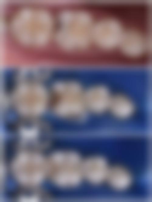 {榆林补牙医院在线咨询24小时：榆林优牙口腔补牙160元起，医生专业技术好！ 