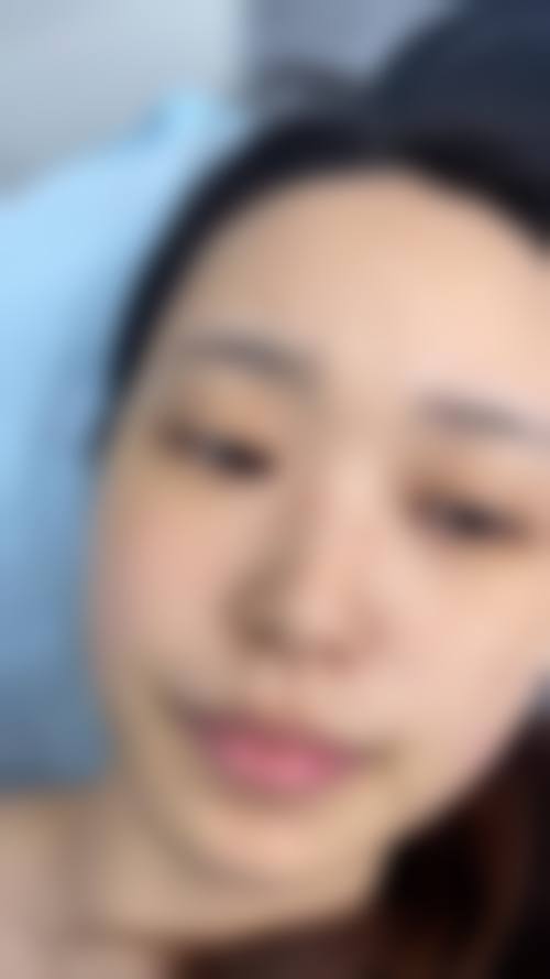 五、宁德初恋密语整形医院收费价格表