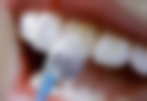 全瓷牙冠与常见物品硬度对比：一较高下见分晓