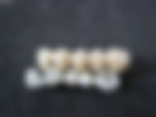 北京冠美口腔医院种牙优惠