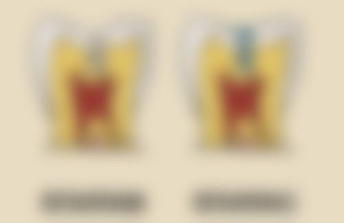 不同人群种牙方案推荐