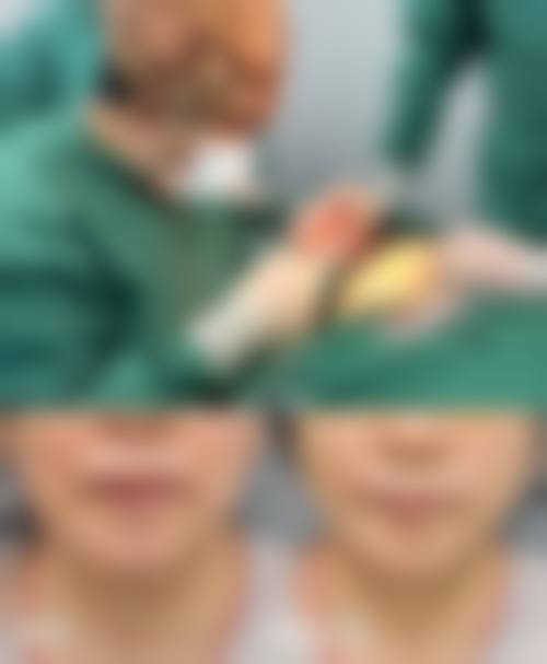 六、东莞圣之慧医疗美容门诊部收费价格表