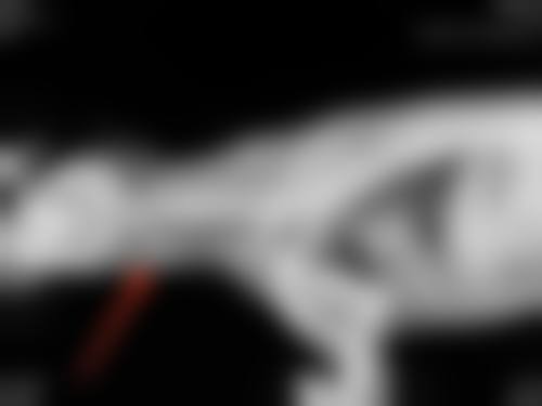 五、香港SWISSOBeautyExpert整形收费价格表