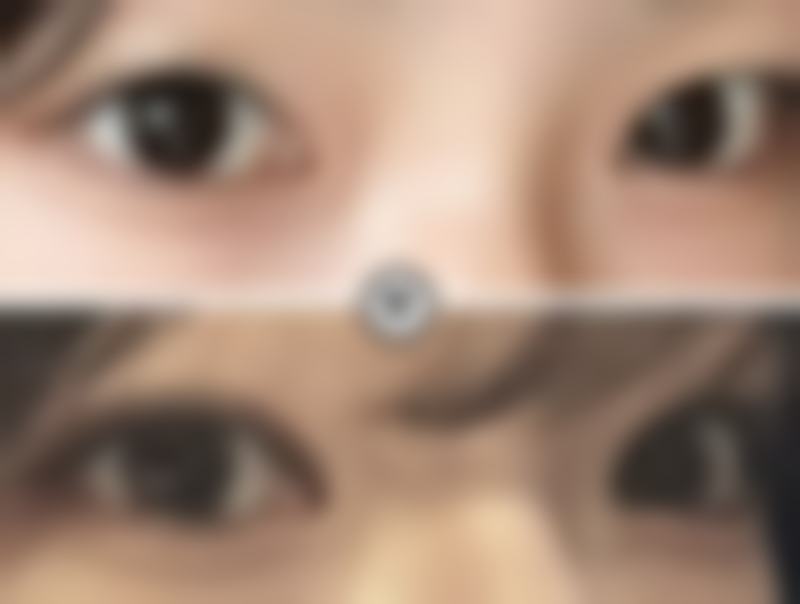 二、香港SWISSOBeautyExpert整形是正规医院吗