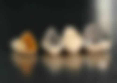 专精医院拔牙好，[XX口腔医院]优势多