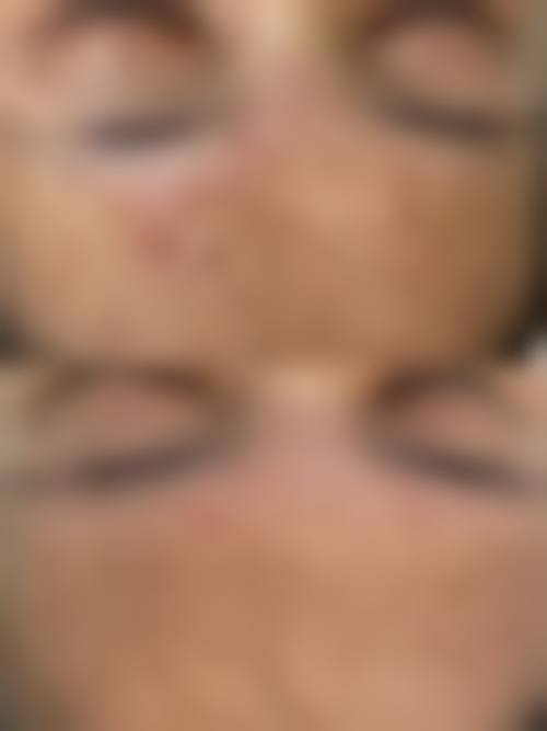 六、成都芮尔医疗美容诊所口碑怎么样？