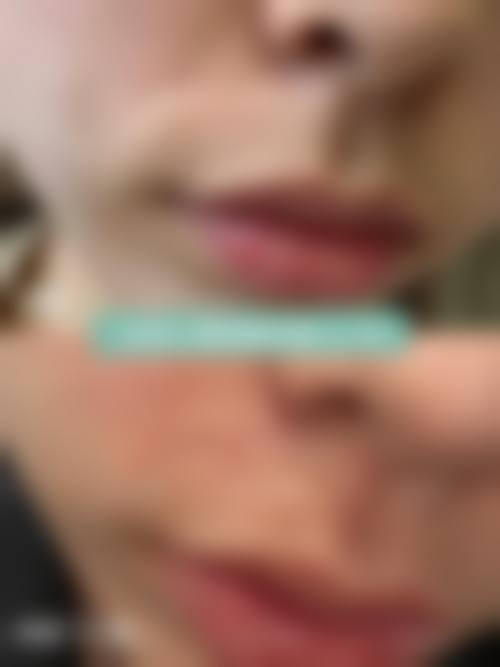 七、沈阳汇美人整形医院口碑怎么样