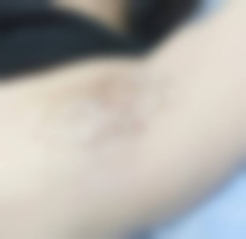 八、沈阳汇美人整形医院预约挂号方式及流程