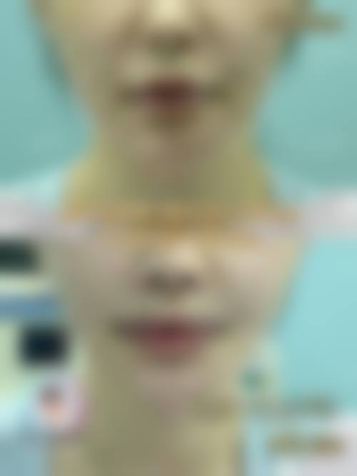 六、沈阳汇美人整形医院收费价格表