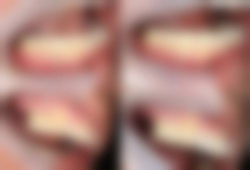 南宁柏乐口腔口碑如何？