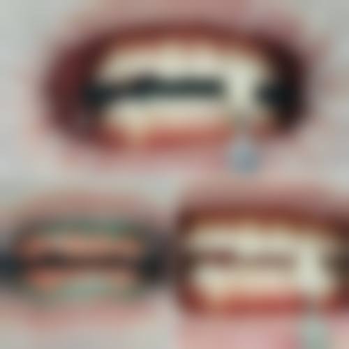 南宁柏乐口腔有优惠活动吗？