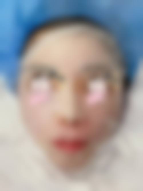 五、安阳容美整形医院收费价格表