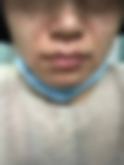 四、安阳容美整形医院特色项目及技术优势