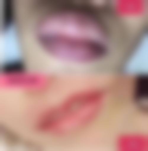 陈露医生价格表