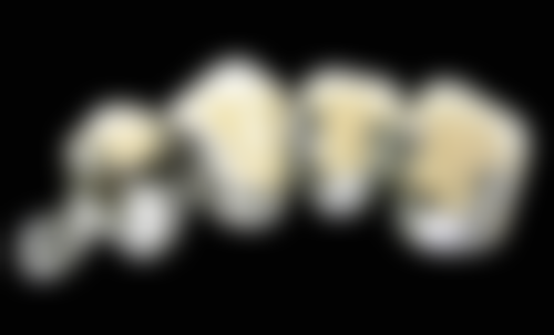 五、牙齿矫正,衡阳哪家医院更靠谱?