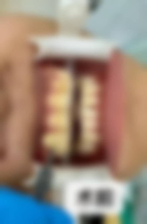 因疾病补牙报销的具体条件和范围