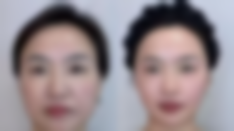 五、武汉美仑整形医疗美容医院收费价格表