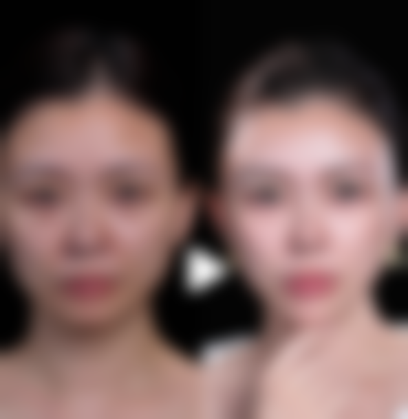 陈露医生坐诊医院