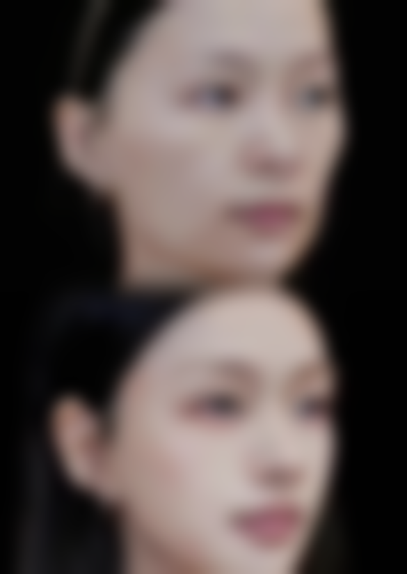 陈露医生技术优势