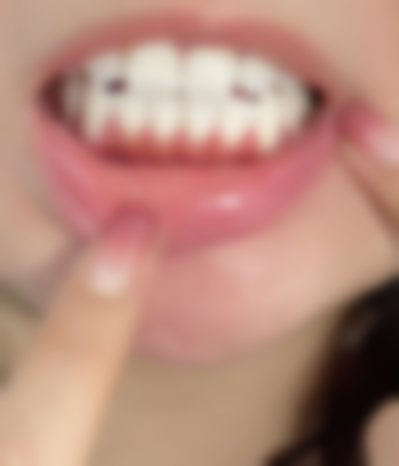 上海交通大学医学校附属第九人民医院:领跑技术,氧化锆全瓷牙修复先锋