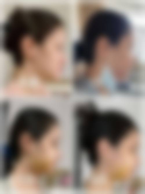 四、山东青岛佳蒂医疗美容特色项目及技术优势