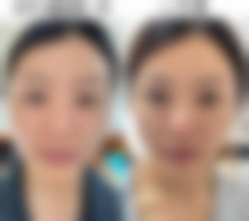 六、山东青岛佳蒂医疗美容口碑怎么样？