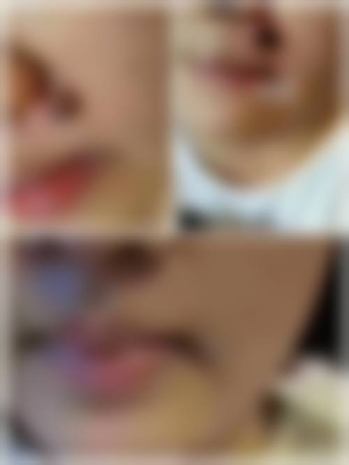 三、深圳赋新颜整形医院地址电话营业时间