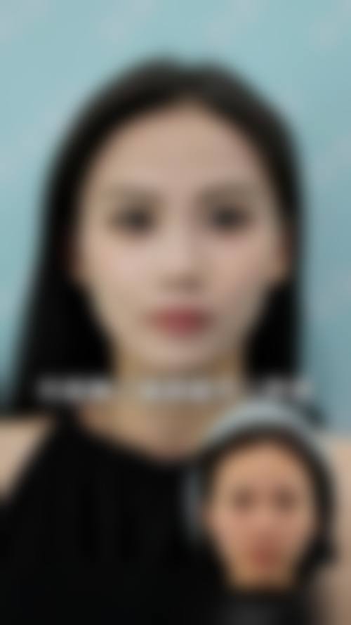 二、深圳赋新颜整形医院是正规医院吗