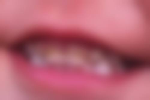 孕期口腔护理：保持口腔健康的重要措施