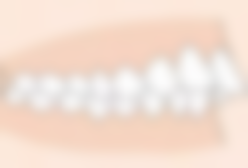 孕前口腔检查：预防孕期牙齿问题的关键