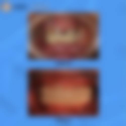 绵阳牙科收费情况