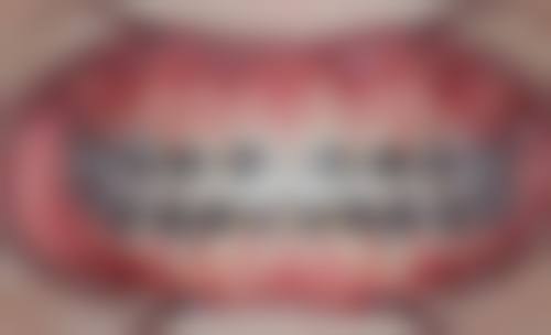 {安溪比较靠谱的口腔医院排名表，含艾美、波波、安格尔等多家门诊部详细分析！ 