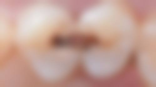 二、安溪国有医院口腔科有啥优势?