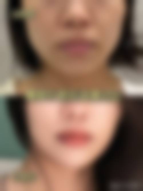 五、朔州丽都整形美容医院收费价格表