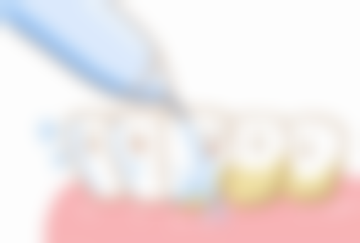 真实见证：中诺口腔的手术成效与实例