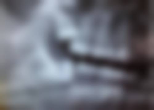 根管治疗不完善,重新治疗是关键