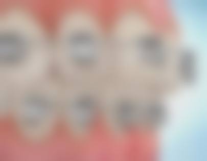 {重庆儿童牙科24小时在线咨询靠谱吗？当然！公立私立任你选，价格透明服务优 