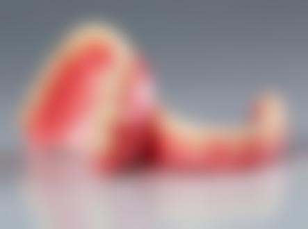 牙外伤致松动,处理有方法